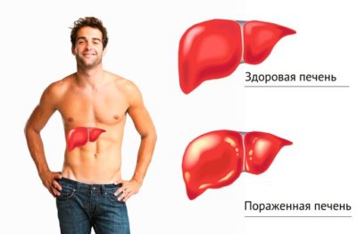 Причины развития гепатита С: симптомы и лечение Причины развития гепатита С: симптомы и лечение