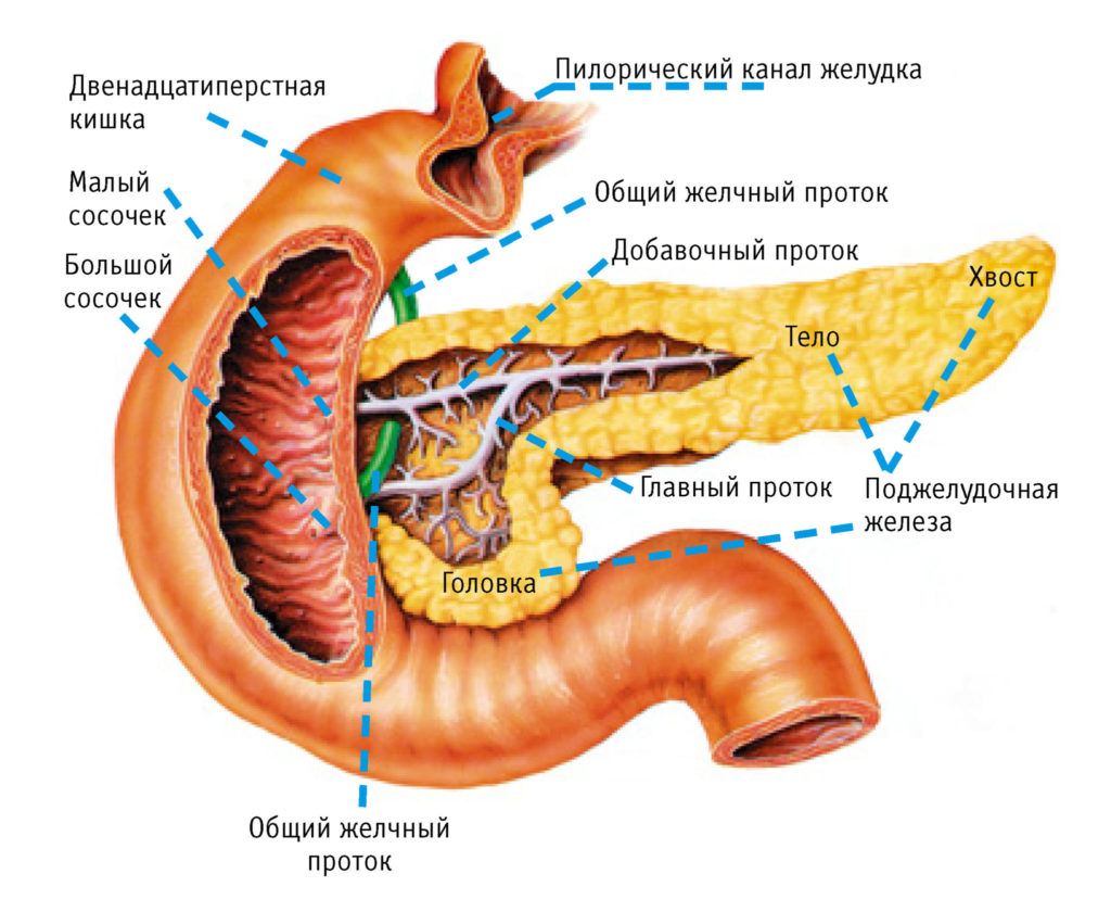 Липоматоз (стеатоз) поджелудочной железы
