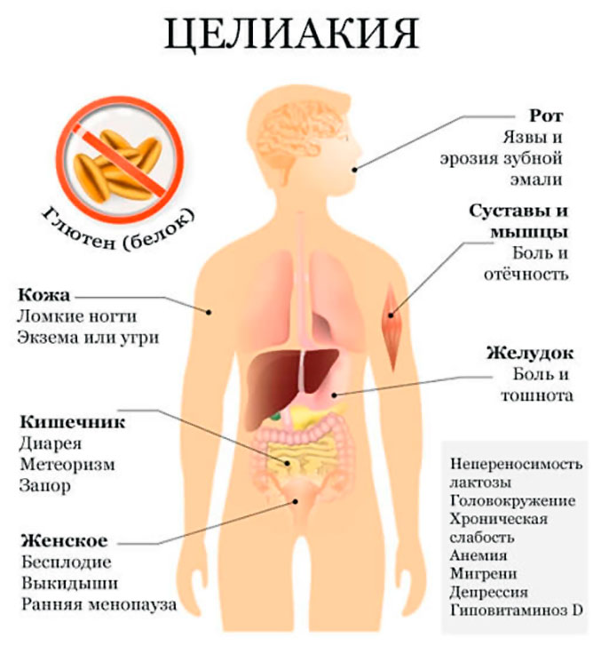 Историю болезни полное отсутствие зубов