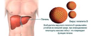 Вирусный гепатит С, анализ и лечение, как передается
