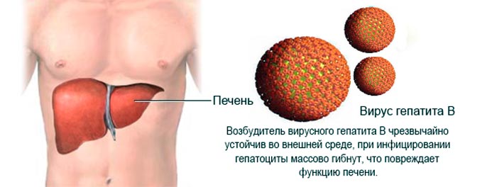 Тяжелая форма гепатита