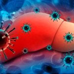 Симптомы и лечение хронического вирусного гепатита С