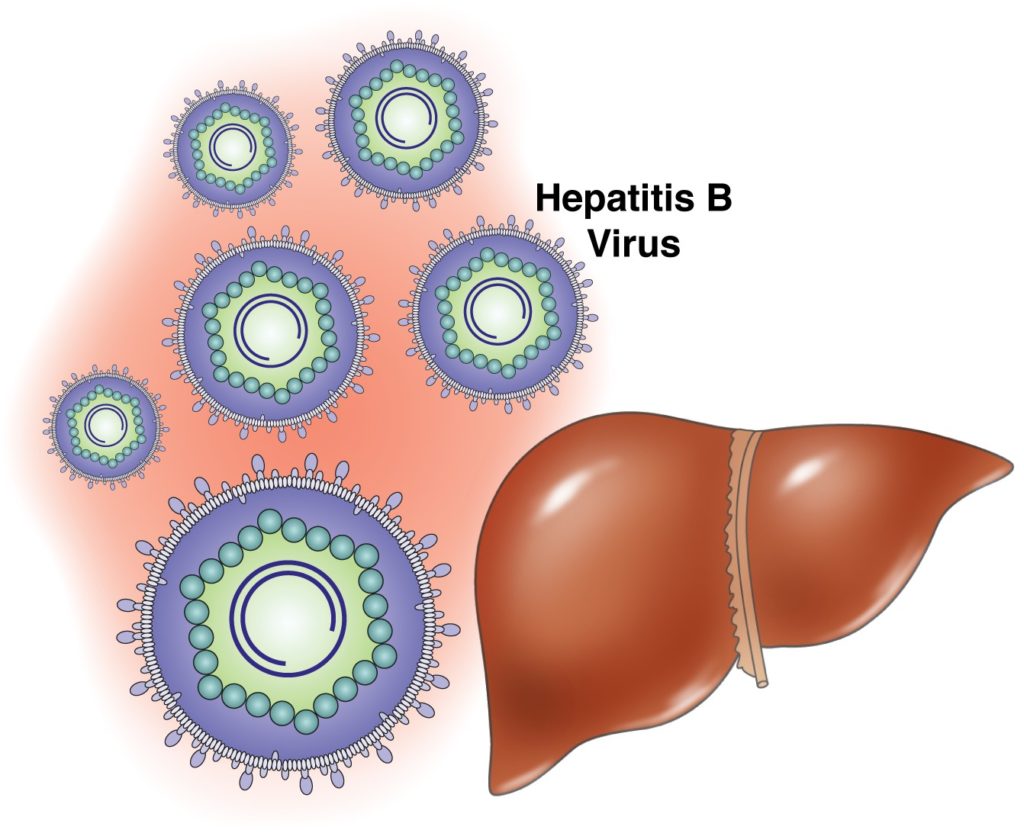 Способы заражения вирусным гепатитом В, симптомы и лечение
