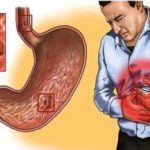 Методы исследования желудка, способы диагностики
