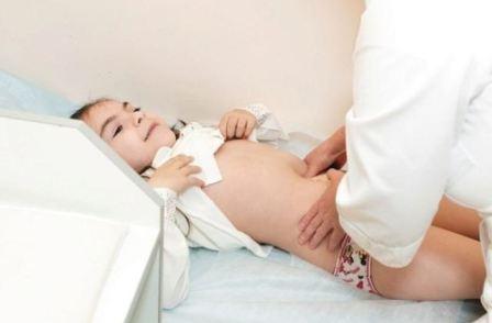 Болезнь Гиршпрунга у детей и новорожденных